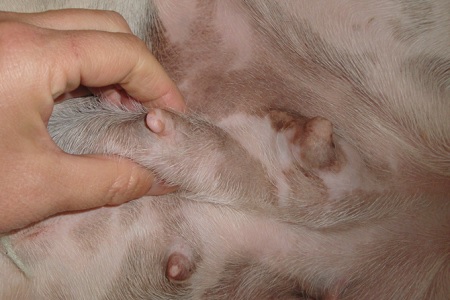 mammelle nodulo tumore palpazione